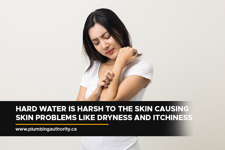 Hard water is harsh to the skin causing skin problems like dryness and itchiness. 